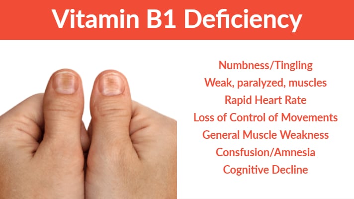 vitamin-b1-deficiency